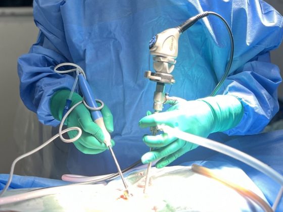 During endoscopic spine surgery